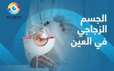 معلومات عن عملية الجسم الزجاجي في العين
