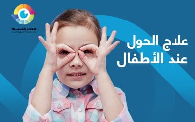 علاج الحول عند الأطفال