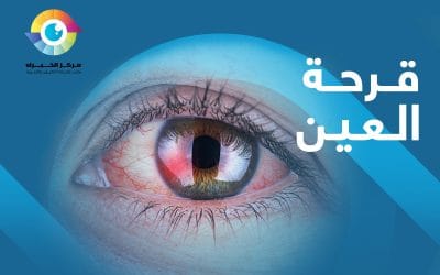 ما هي قرحة العين؟ وهل يمكن اكتشافها؟