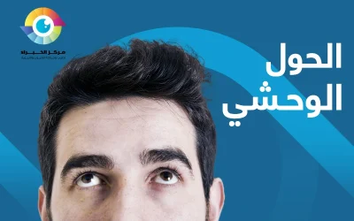 أعراض الحول الوحشي عند الأطفال؟ اسبابه وعلاجة
