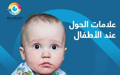 انتبه إلى علامات الحول عند الاطفال وبادر بالكشف الطبي!
