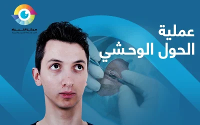 ما بعد عملية الحول الوحشي | شبح الحول ما زال..