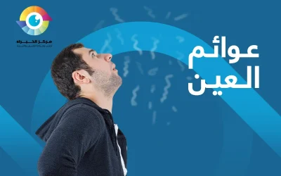 عوائم العين أو الذبابة السوداء | علاجها ببساطة..