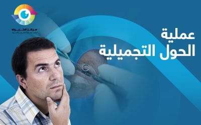 عملية الحول التجميلية | ما هي؟ ومتى يحتاج طفلك إليها