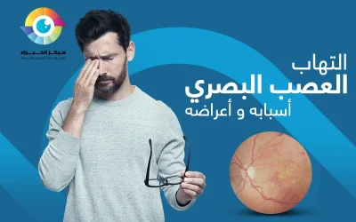 التهاب العصب البصري أعراضه وعلاجه