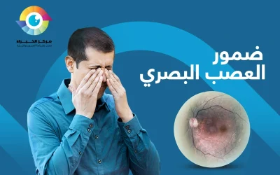 ضمور العصب البصري | هل من علاج؟