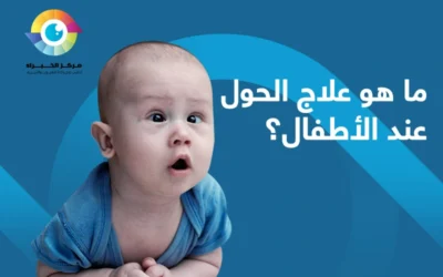 ما هو علاج الحول عند الأطفال، وما هي مدة علاجه؟