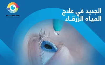 الجديد في علاج المياه الزرقاء | مركز الخُبراء للعيون