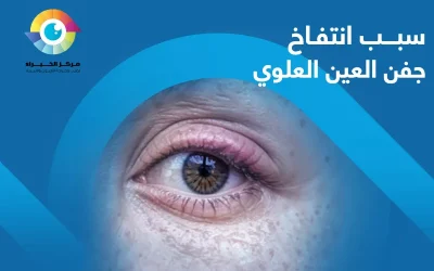 البكاء ليلًا ليس سبب انتفاخ جفن العين العلوي الوحيد!