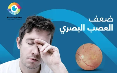 ضعف العصب البصري | خطر صامت انتبه إليه