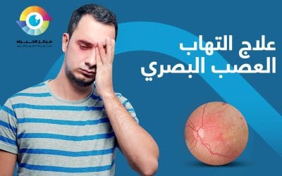 ما هو التهاب العصب البصري | وهل يمكن الشفاء التام منه؟