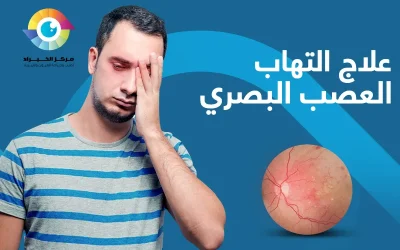 علاج التهاب العصب البصري | مبكرا يحميك من فقدان البصر!