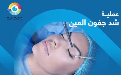كم تستمر نتيجة عملية شد جفون العين؟