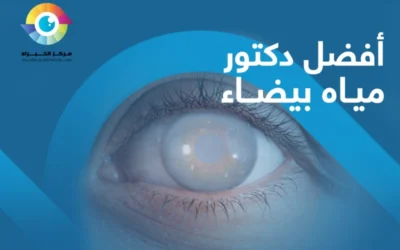 مَن هو افضل دكتور مياه بيضاء؟ للعلاج المناسب