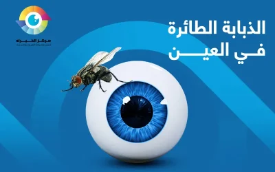 ذبابة العين : أسباب وأعراض العوائم وطرق العلاج