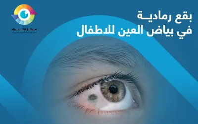 أسباب وعلاج بقع رمادية في بياض العين للاطفال والكبار