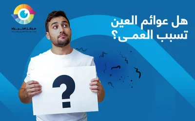 هل عوائم العين تسبب العمى؟ اعرف الأسباب والعلاج