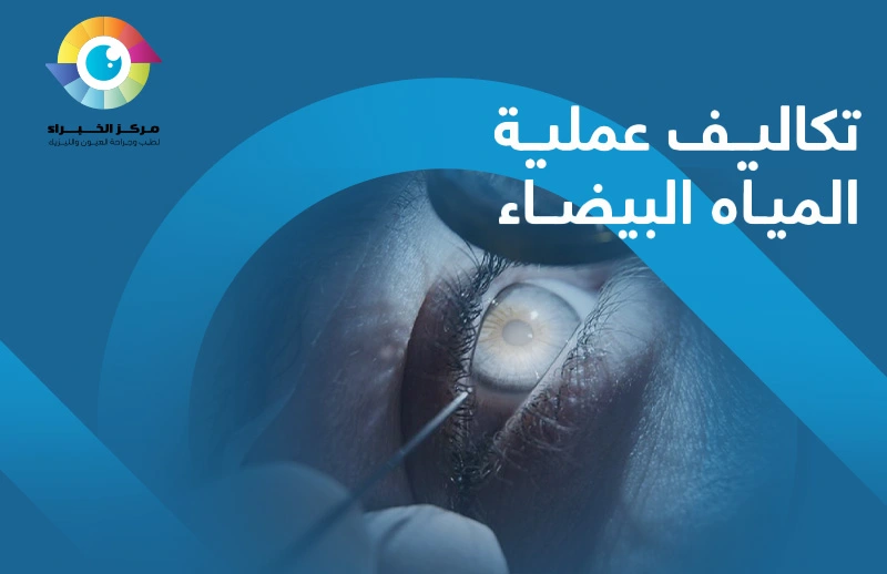 تكاليف عملية المياه البيضاء