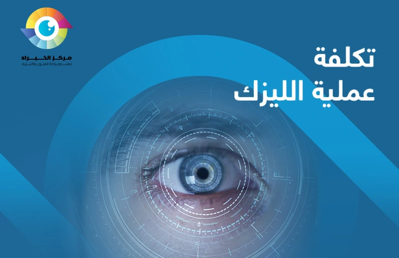 تكلفة عملية اللزيك