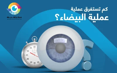 كم تستغرق عملية المياه البيضاء؟