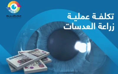 أسباب تفاوت تكلفة عملية زرع العدسات في مصر 