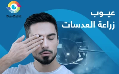 تعرف إلى عيوب زراعة العدسات ومميزاتها