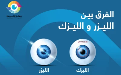 ما الفرق بين الليزر والليزك؟ وأيهما أفضل لك؟  