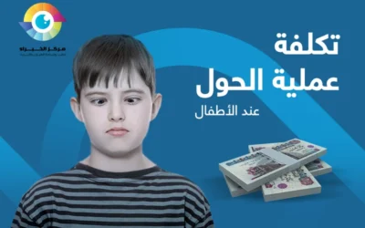 ما العوامل المختلفة المؤثرة في تكلفة عملية الحول للأطفال؟