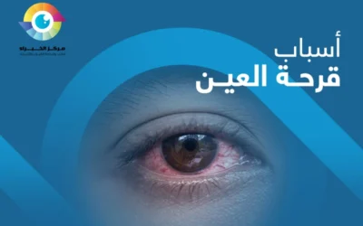 اسباب قرحة العين | كيف تحمي عينيك من الخطر؟