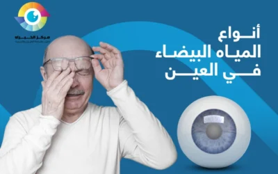 جميع أنواع المياه البيضاء في العين بالتفصيل
