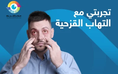 تجربتي مع التهاب القزحية | أعراضه وأسبابه وسُبل علاجه