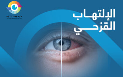 الالتهاب القزحي