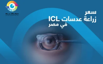 كم يبلغ سعر زراعة عدسات ICL في مصر؟