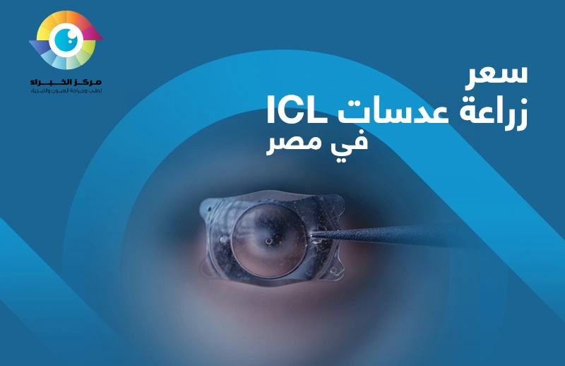 سعر زراعة عدسات icl في مصر