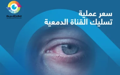 ما العوامل المؤثرة في سعر عملية تسليك القناة الدمعية؟