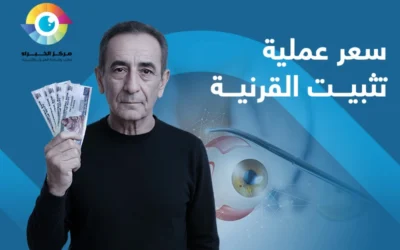 معايير تُحدد سعر عملية تثبيت القرنية