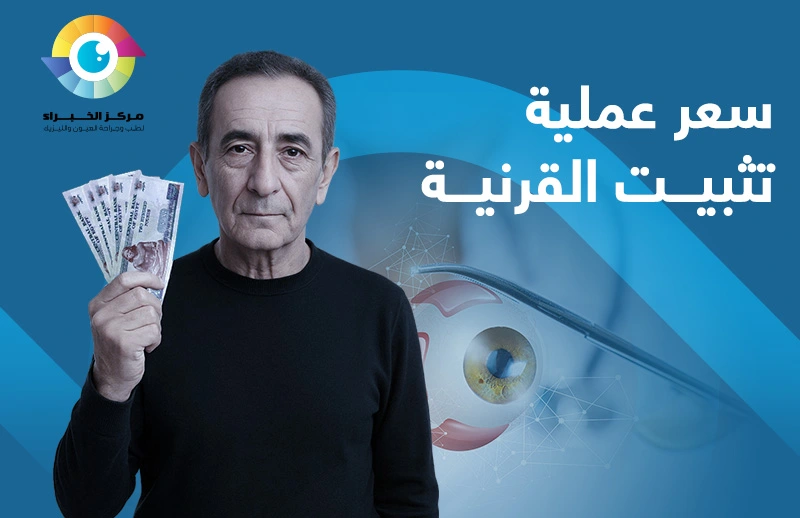 سعر عملية تثبيت القرنية
