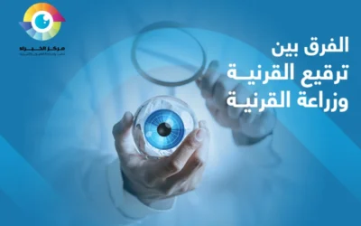 تعرف إلى الفرق بين ترقيع القرنية و زراعة القرنية مع مركز الخبراء للعيون