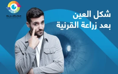 كيف يبدو شكل العين بعد زراعة القرنية؟