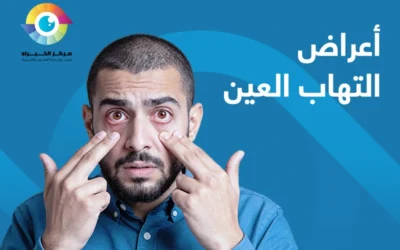 متى تصبح اعراض التهاب العين خطيرة؟