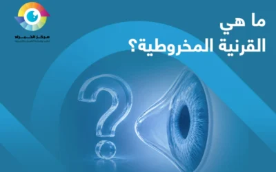 ما هي القرنية المخروطية؟ وهل يمكن علاجها؟