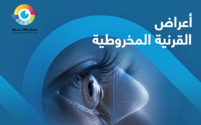 اعراض القرنية المخروطية.. التغافل عنها قد يهدد بصرك